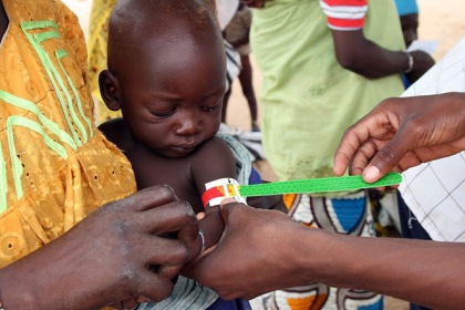 Desnutrición infantil en Níger